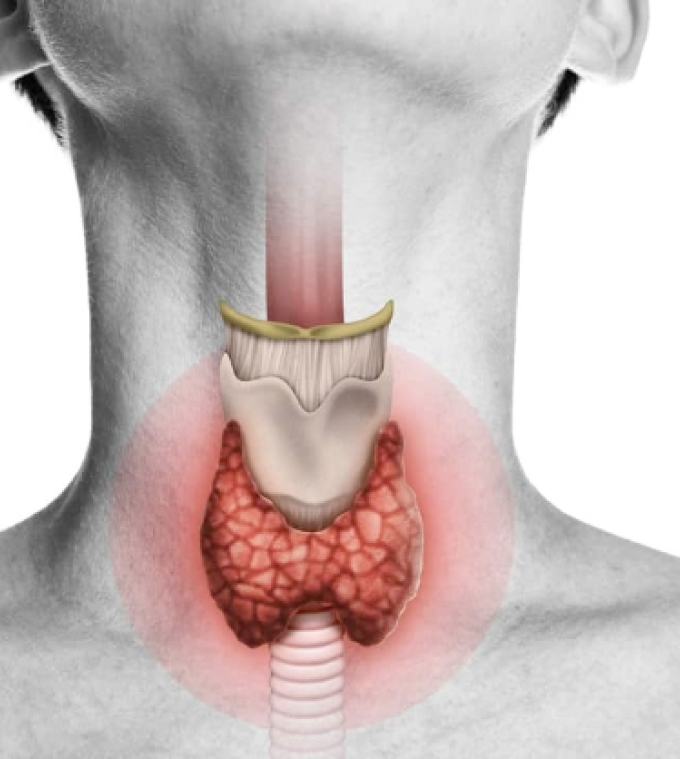 Endocrine Surgery by Dr Aaron Ndhluni, Specialist Surgeon in Cape Town.